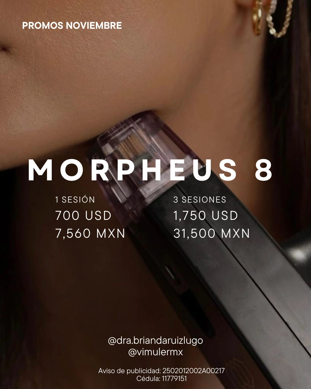 Vimuler2 (Post para Instagram (45)).png_resultado